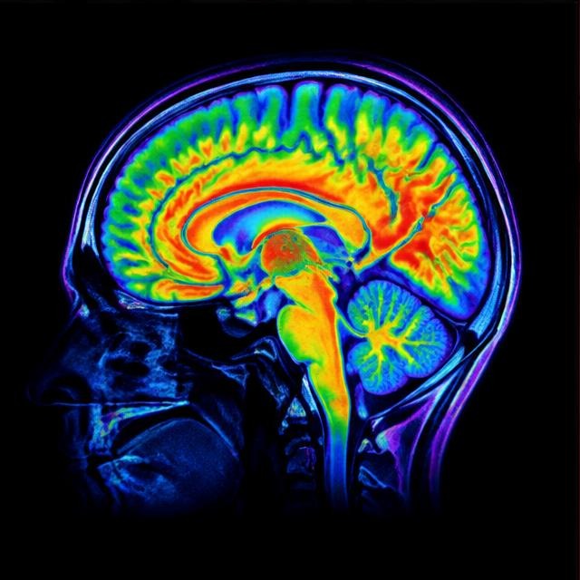 A colorful brain scan against a dark background
